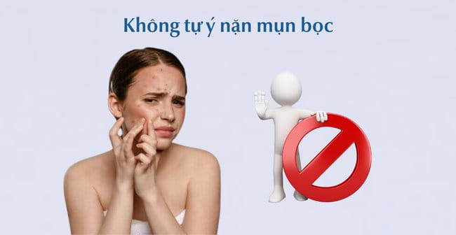 Mụn bọc có nên nặn không?