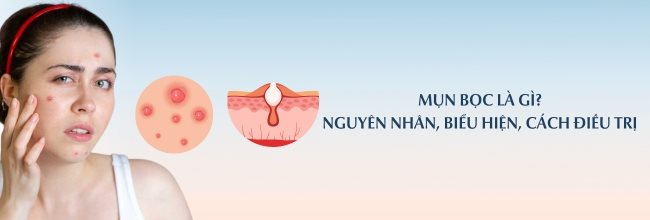 mụn bọc là gì