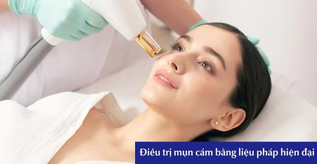 Điều trị mụn cám bằng liệu pháp hiện đại