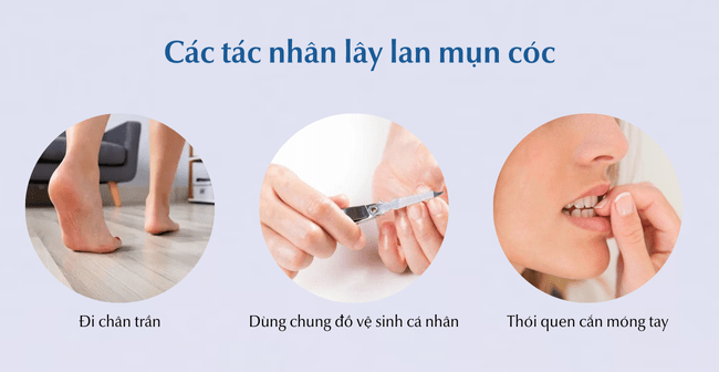 Tác nhân khiến lây lan bệnh