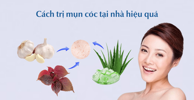 Cách trị mụn cóc tại nhà hiệu quả