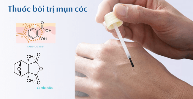 Thuốc bôi trị mụn