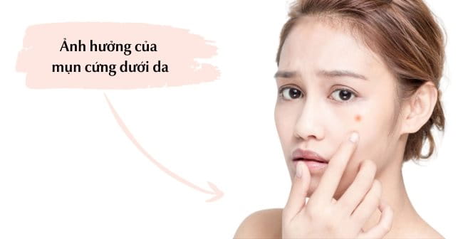 Tác hại của mụn cứng tới da