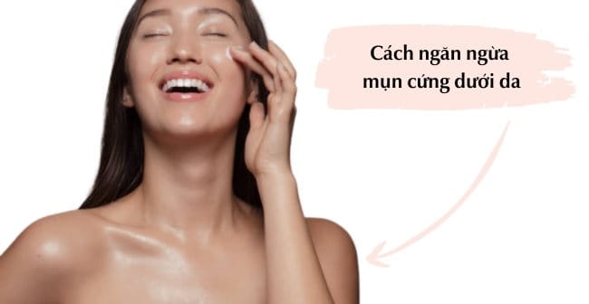 Ngăn ngừa mụn cứng dưới da