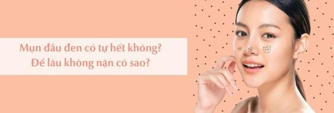 Mụn đầu đen có tự hết được không?