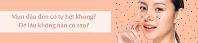 Mụn đầu đen có tự hết được không?