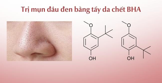 AHA/BHA trị mụn đầu đen ở mũi