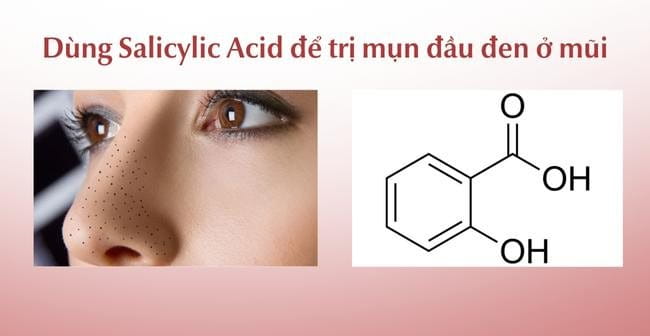 Sử dụng Salicylic Acid để trị mụn đầu đen ở  mũi