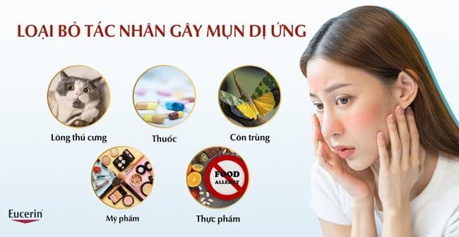 Loại bỏ tác nhân gây mụn dị ứng