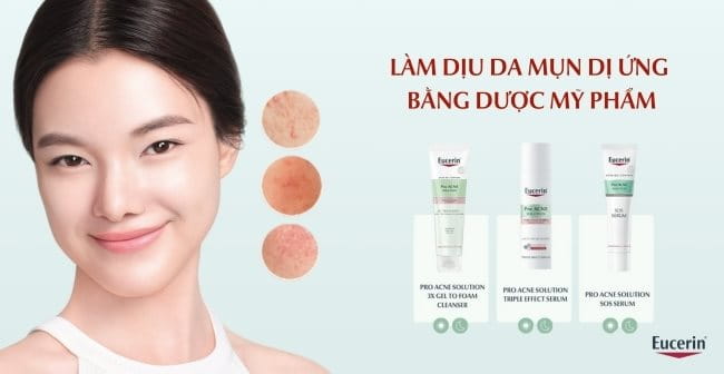 Làm dịu da mụn kích ứng với dược mỹ phẩm