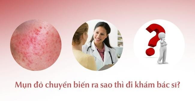 Chuyển biến của mụn đỏ, nổi hột đỏ trên da bạn cần khám bác sĩ