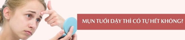 Mụn tuổi dậy thì có tự hết không