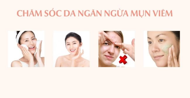 Cách chăm sóc da ngăn ngừa mụn viêm