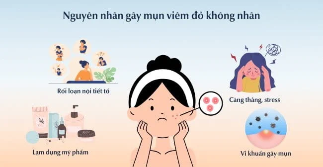 Nguyên nhân gây mụn viêm đỏ không nhân