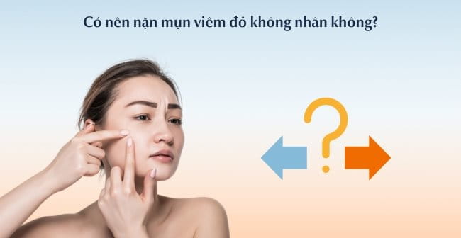 Có nên nặn mụn viêm đỏ không nhân không?