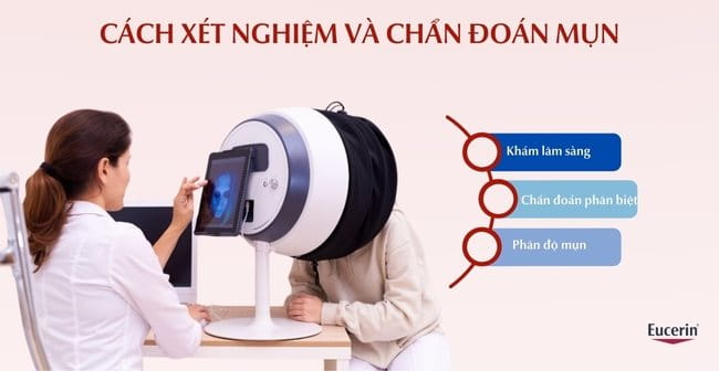 Cách xét nghiệm và chẩn đoán mụn