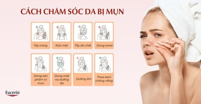 Các bước chăm sóc da mụn