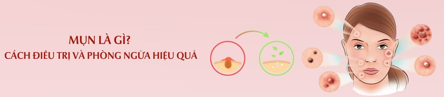 Trị Mụn Hiệu Quả Không Thuốc Với ACNE STUDIO by PMT