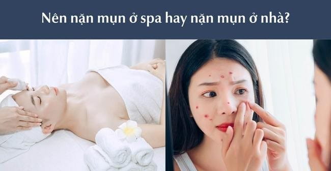 Nên nặn mụn ở spa hay tự nặn mụn ở nhà