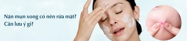 Nặn mụn xong có nên rửa mặt không?