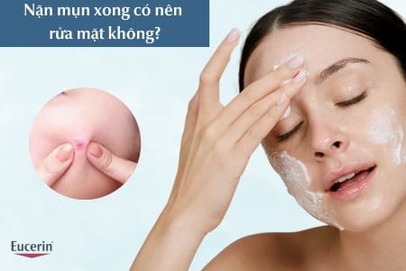 Nặn mụn xong có nên rửa mặt không? 