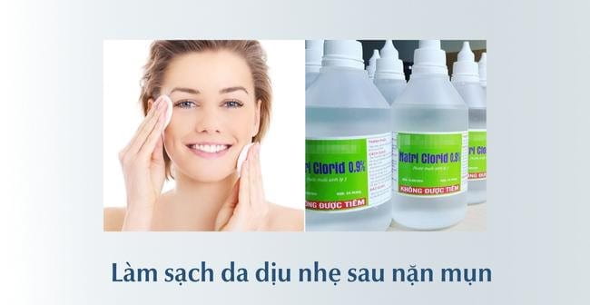Làm sạch da là câu trả lời cho nặn mụn xong nên làm gì
