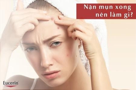 Những cách chăm sóc da sau khi nặn mụn xong nên làm gì 