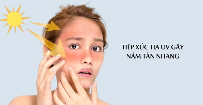 Nguyên nhân bị tàn nhang do tiếp xúc trực tiếp với tia UV