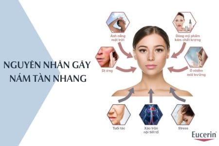 nguyên nhân gây nám tàn nhang