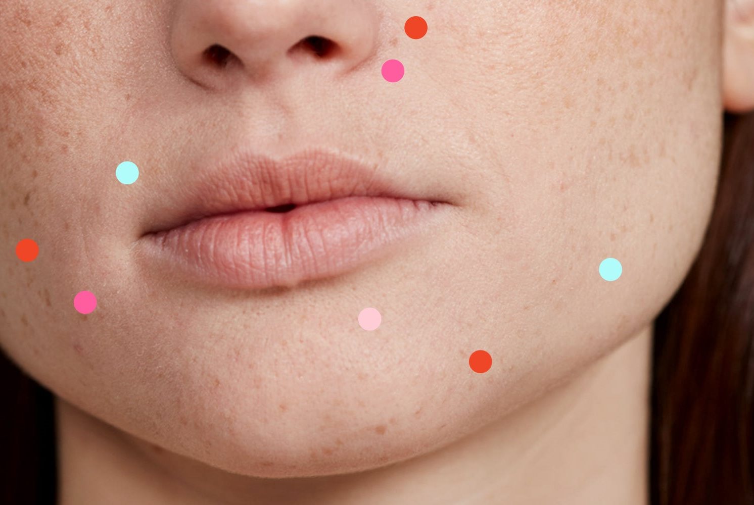 nguyên nhân gây mụn trên mặt