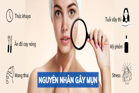 nguyen-nhan-gay-mun-tren-mat-va-cach-dieu-tri-chuan-khoa-hoc