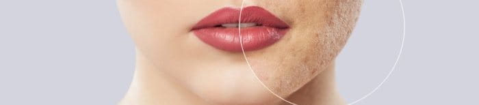 nguyên nhân khiến da xỉn màu