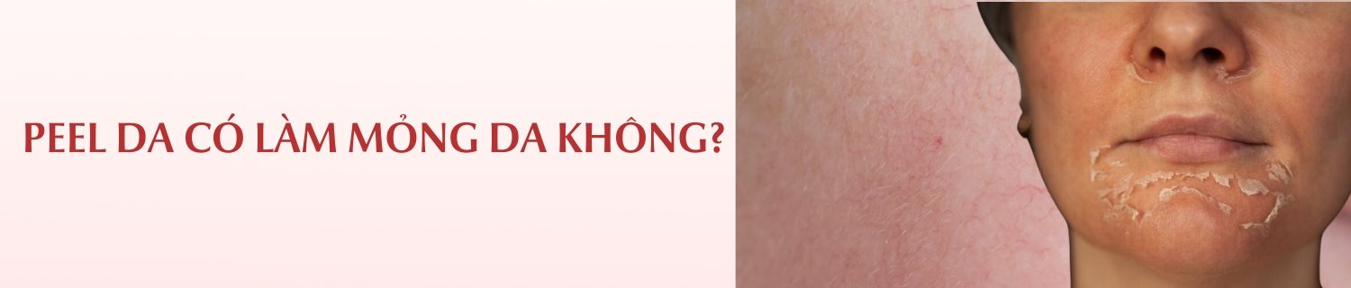 Peel da có làm mỏng da không?