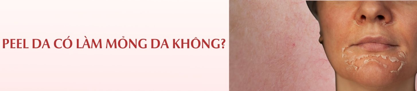 Peel da có làm mỏng da không?