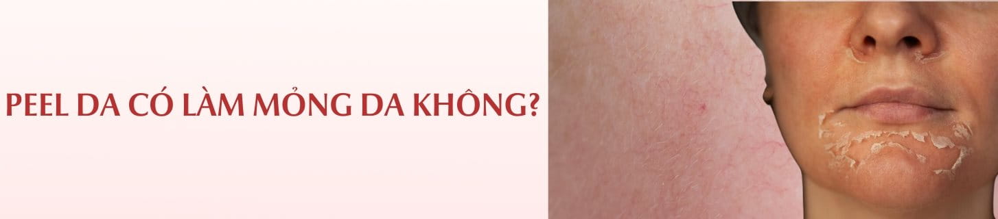 Peel da có làm mỏng da không?