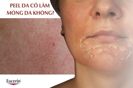 Peel da có làm mỏng da không?