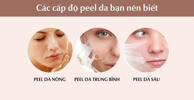 Các cấp độ peel da