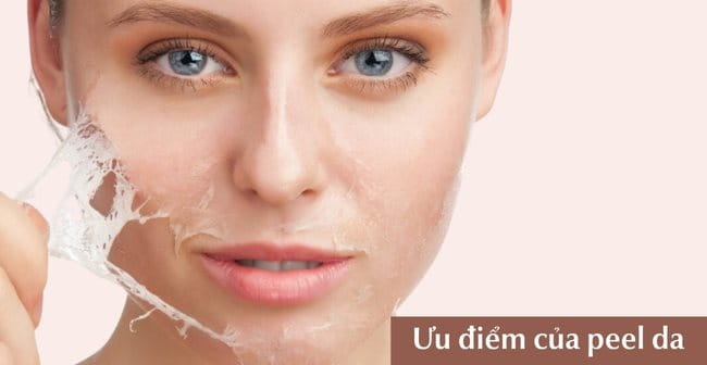 Ưu điểm của peel da