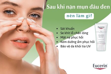 Nặn Mụn Đầu Đen Xong Nên Làm Gì Để Da Sạch Sáng Và Không Thâm?