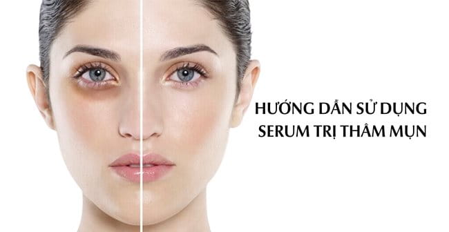 Hướng dẫn sử dụng serum trị thâm mụn sáng da đúng cách