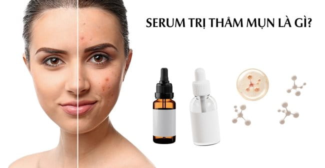 Serum trị thâm mụn là gì?