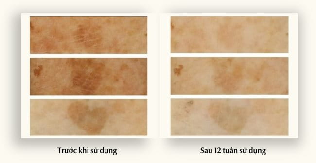 Nghiên cứu lâm sàng của Spotless Body lotion Eucerin