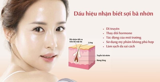 Nguyên nhân gây sợi bã nhờn