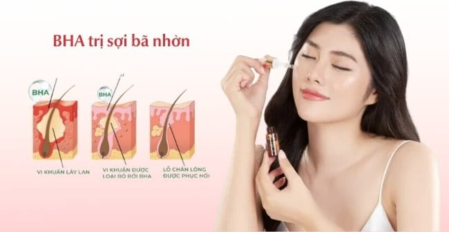 BHA trị sợi bã nhờn