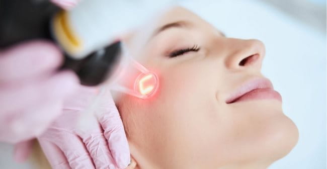 Tái tạo da bằng tia laser