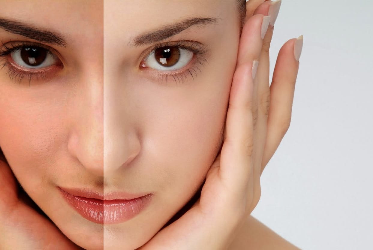 kem dưỡng trắng da mặt cho da dầu