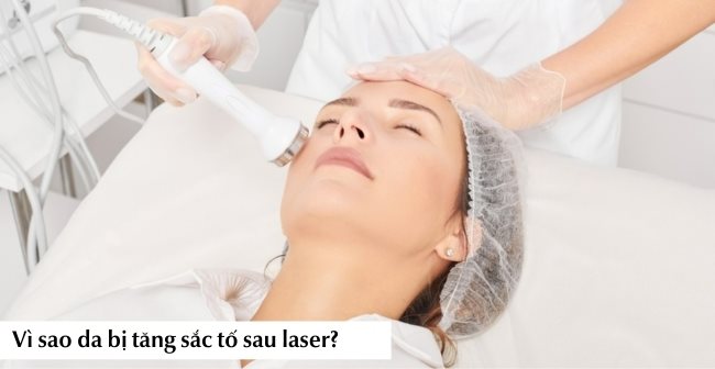 Vì sao da bị tăng sắc tố sau laser?