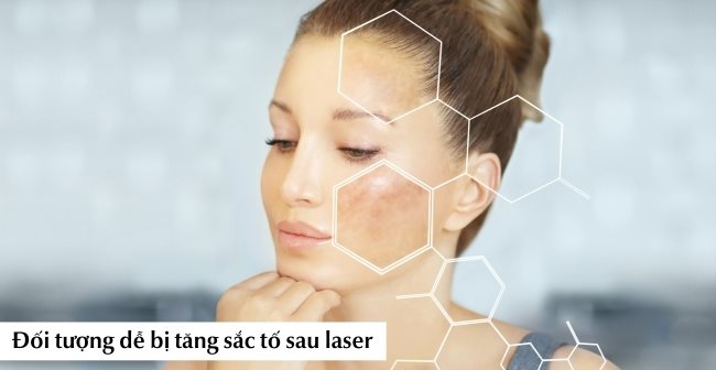 Tăng sắc tố da sau bắn laser là hiện tượng phổ biến, thường gặp ở rất nhiều người 