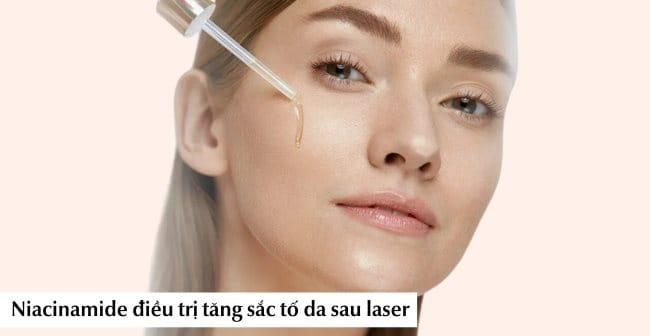 Niacinamide điều trị tăng sắc tố da sau laser