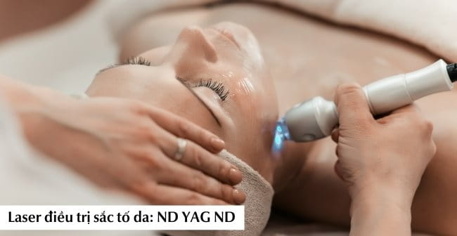 Laser điều trị sắc tố da: ND YAG ND